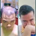 RJanshop-hairgroweraffiliateshop