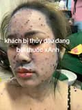 PHUONG ANH BEAUTY VT-thaoduocphuonganhvt