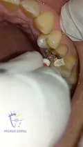 Dentist Premier-nepalidentist